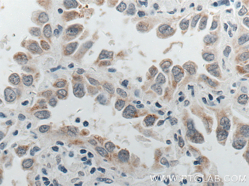 P4HA2 Monoclonal antibody