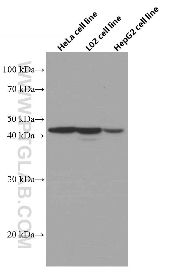Adiponectin receptor 1 Monoclonal antibody