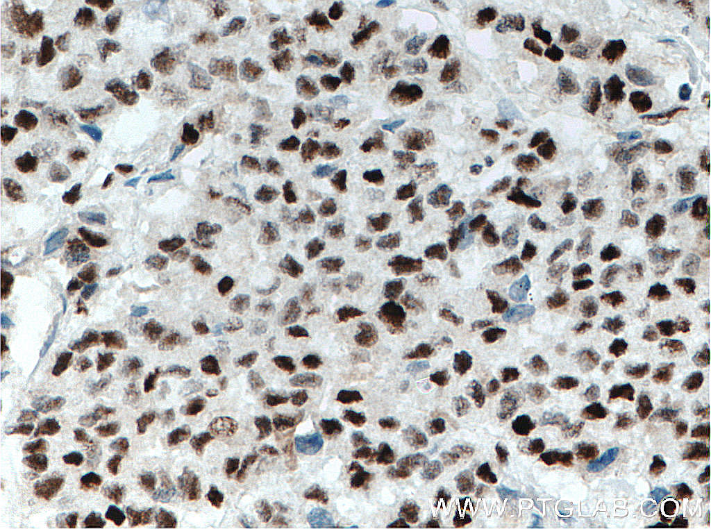 XRCC4 Monoclonal antibody