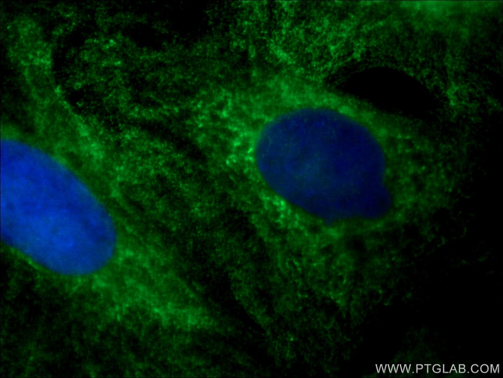 RABEPK/p40 Monoclonal antibody
