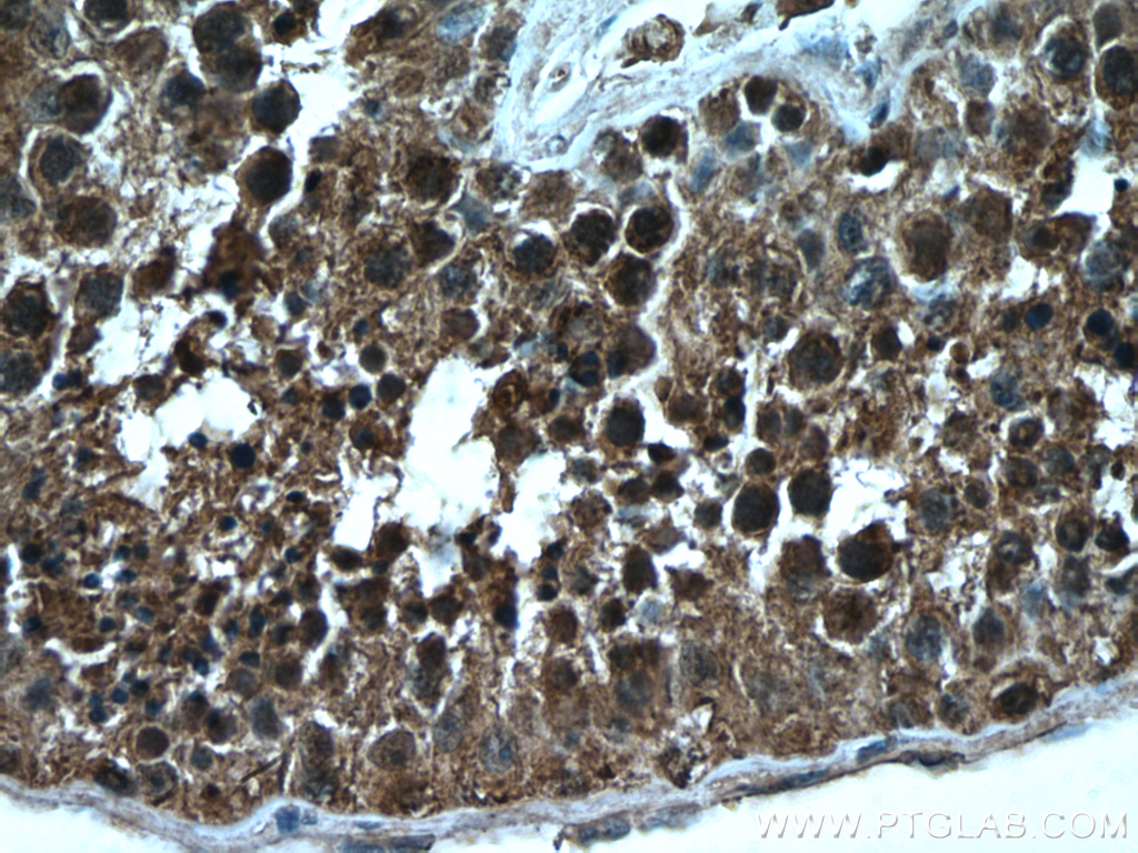 NEK2 Monoclonal antibody