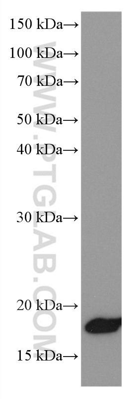 NEUROG1 Monoclonal antibody