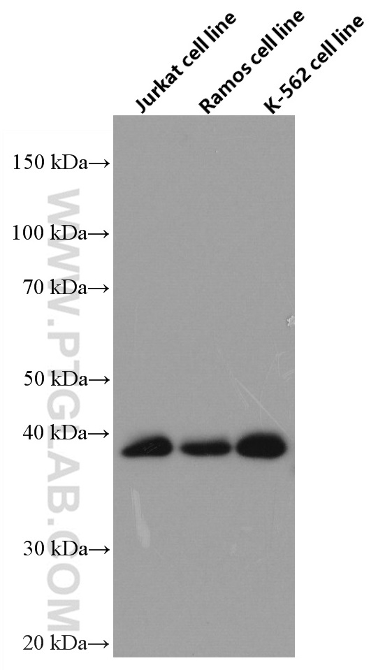 RNF126 Monoclonal antibody