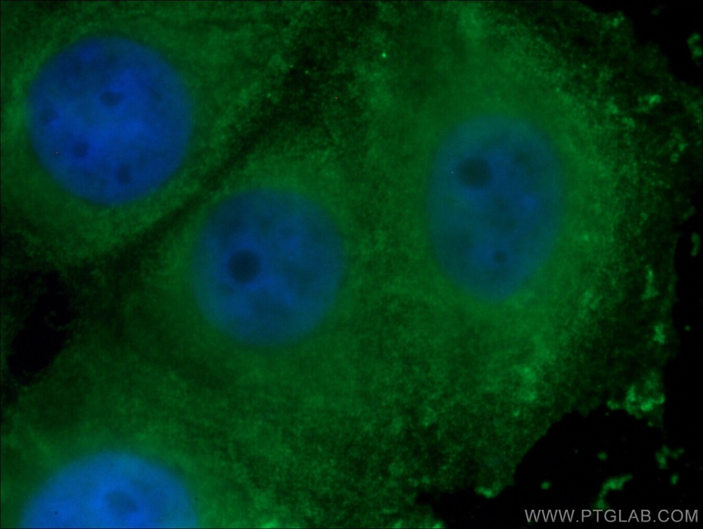 WNT2 Monoclonal antibody