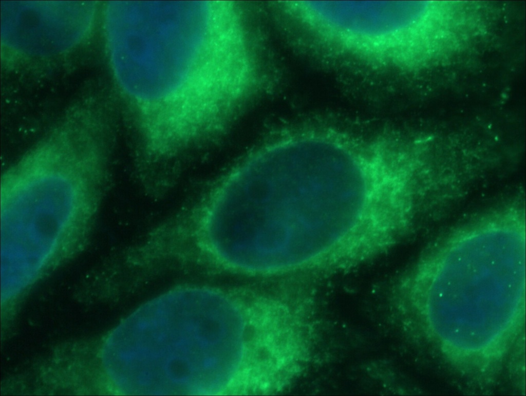 PDIA6 Monoclonal antibody