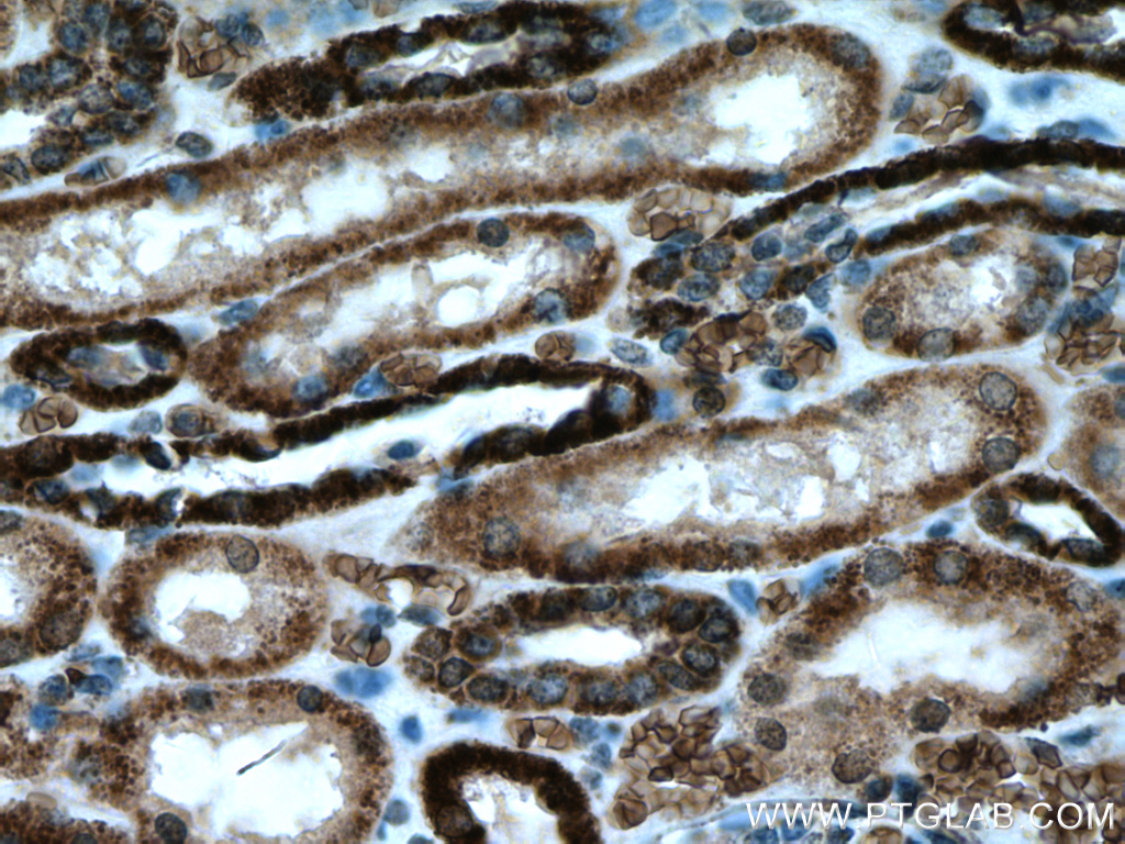 ATP5D Monoclonal antibody