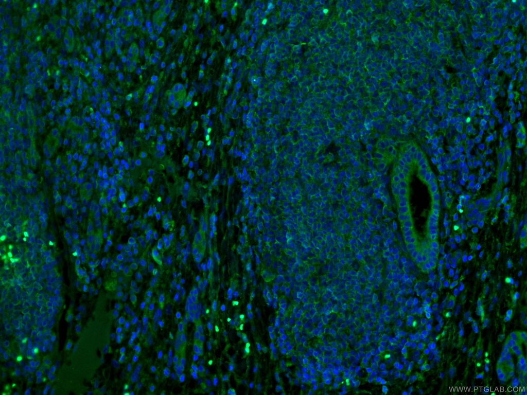 MLKL Monoclonal antibody