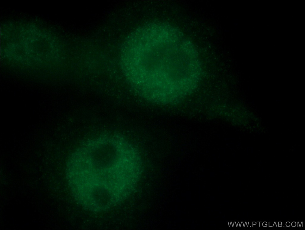 HMG20A Monoclonal antibody