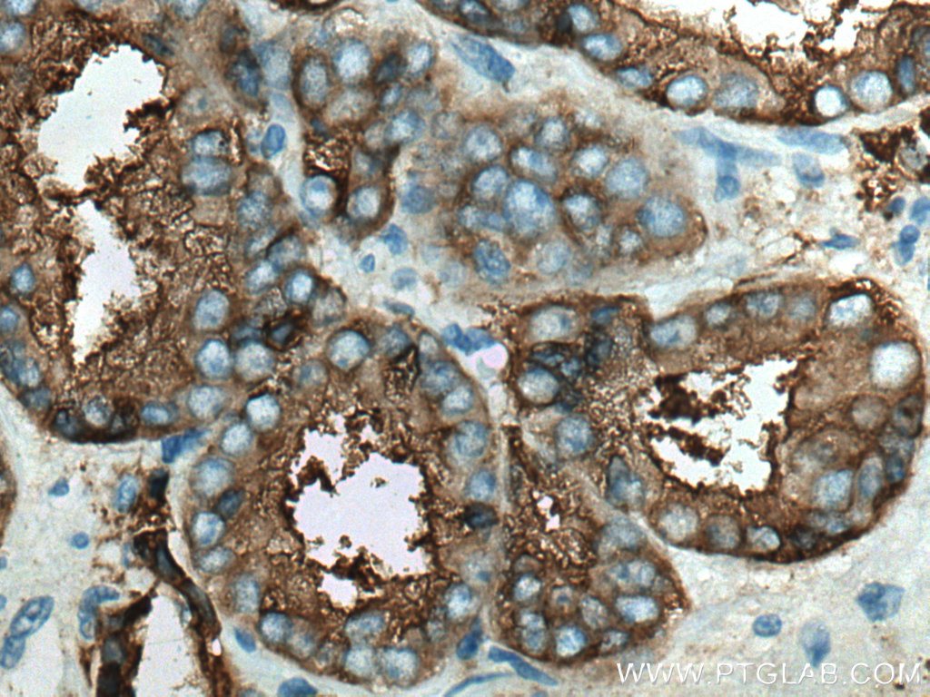 PSMA/GCPII Monoclonal antibody