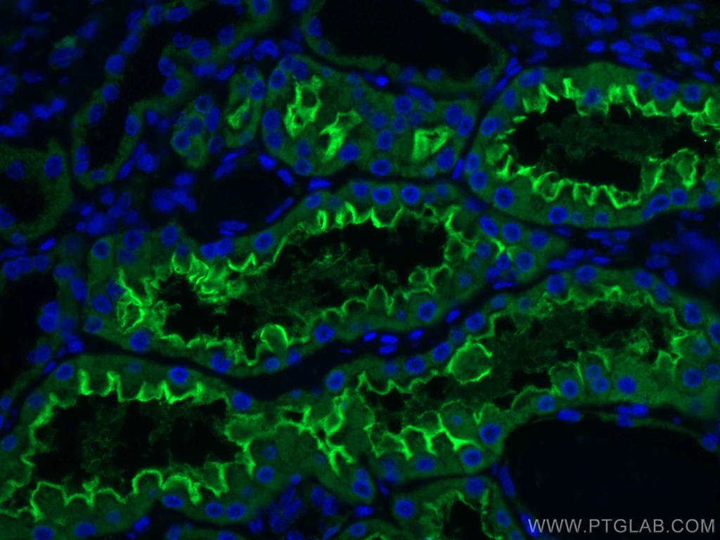 ACE2 Monoclonal antibody