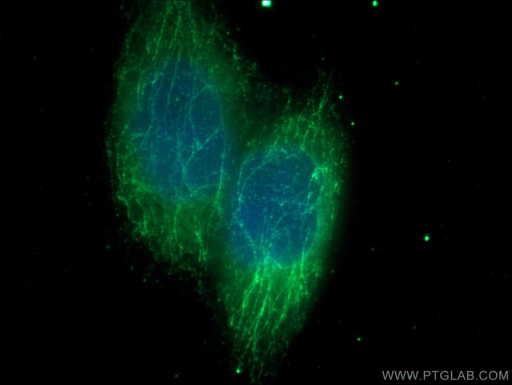 MTAP Monoclonal antibody