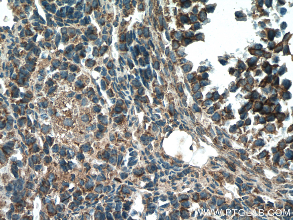 STRAP Monoclonal antibody