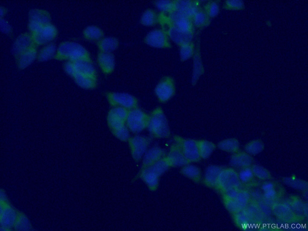 TPT1 Monoclonal antibody