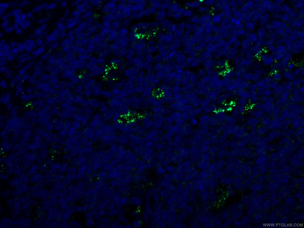 SYK Monoclonal antibody