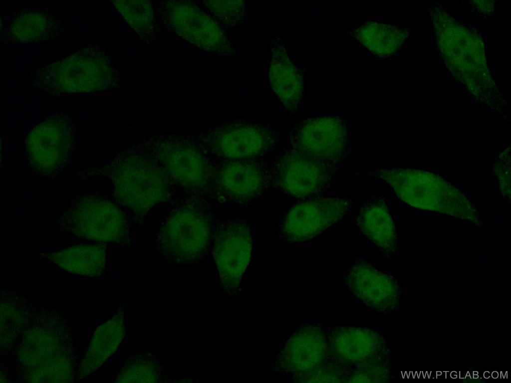 HIF1a Monoclonal antibody