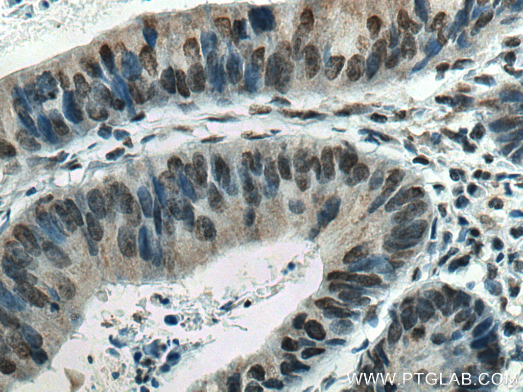 EPAS1 Monoclonal antibody