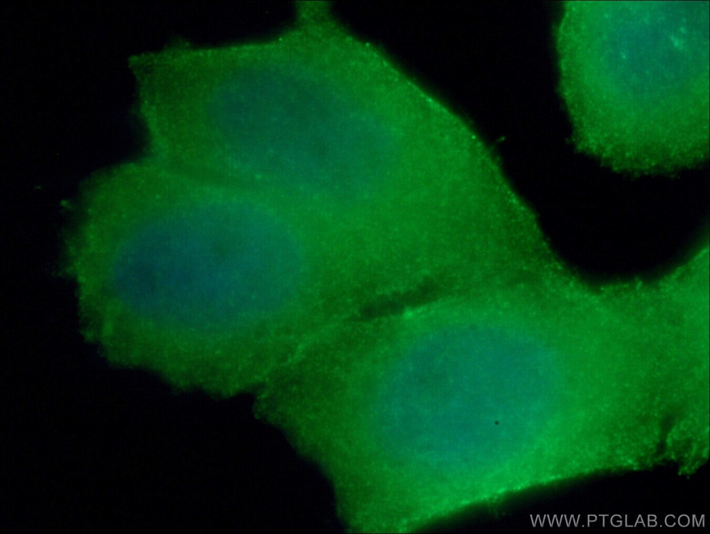 RHOA Monoclonal antibody