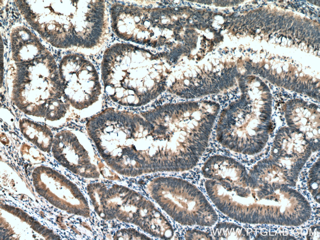 ATG5 Monoclonal antibody