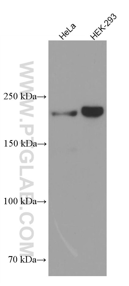 KIAA0284 Monoclonal antibody