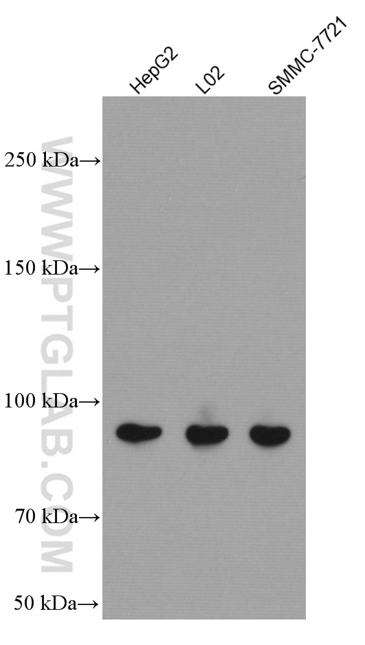 PLA2G4D Monoclonal antibody