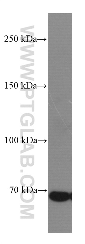 DR6 Monoclonal antibody