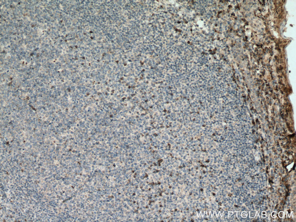 TRAIL Monoclonal antibody
