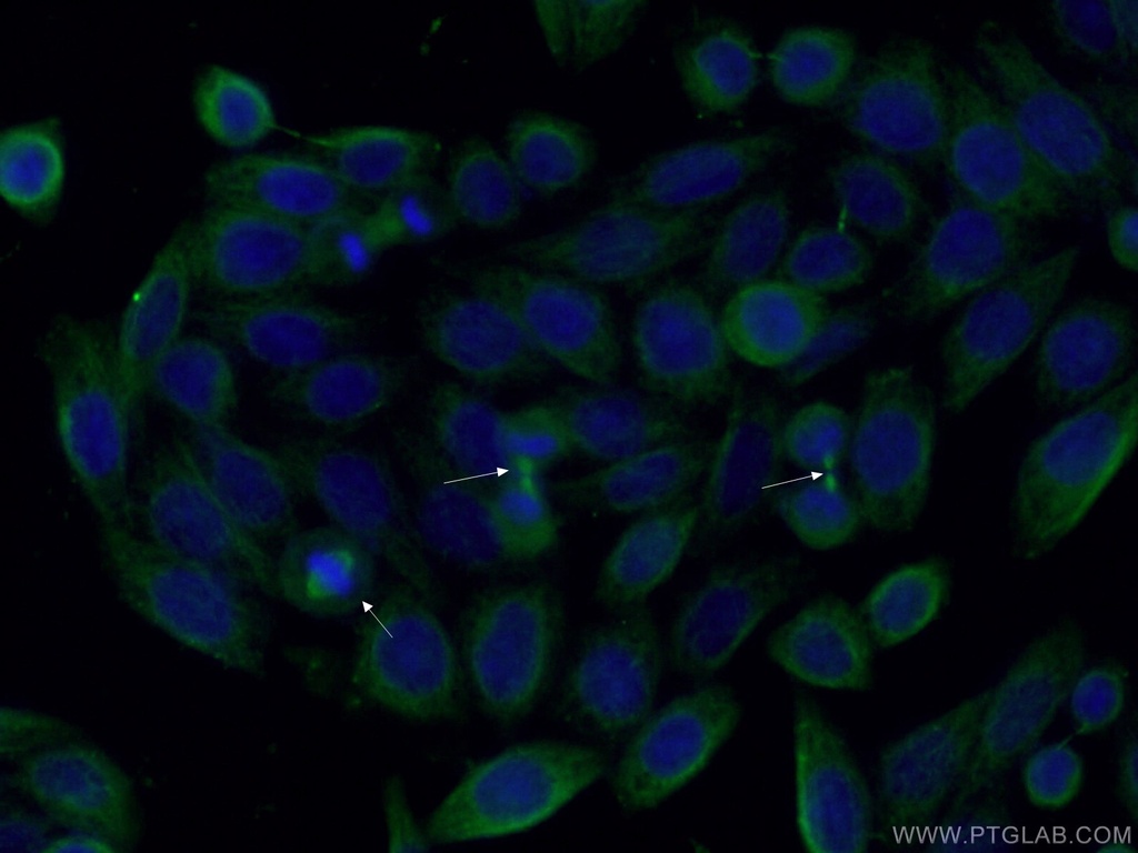 AURKA Monoclonal antibody