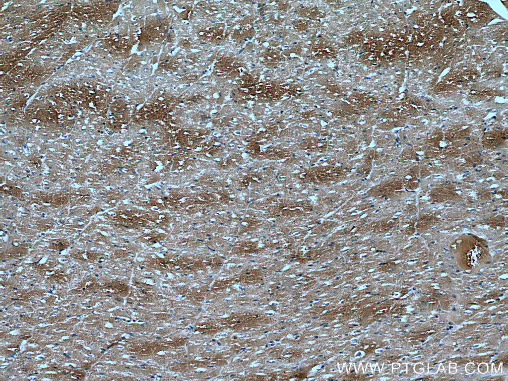 DKK3 Monoclonal antibody