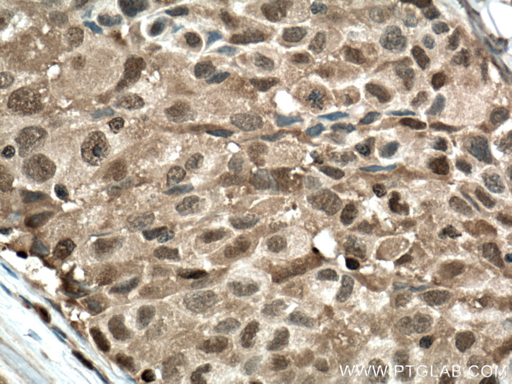 PSMB8 Monoclonal antibody