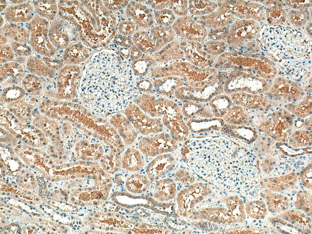 STX3 Monoclonal antibody