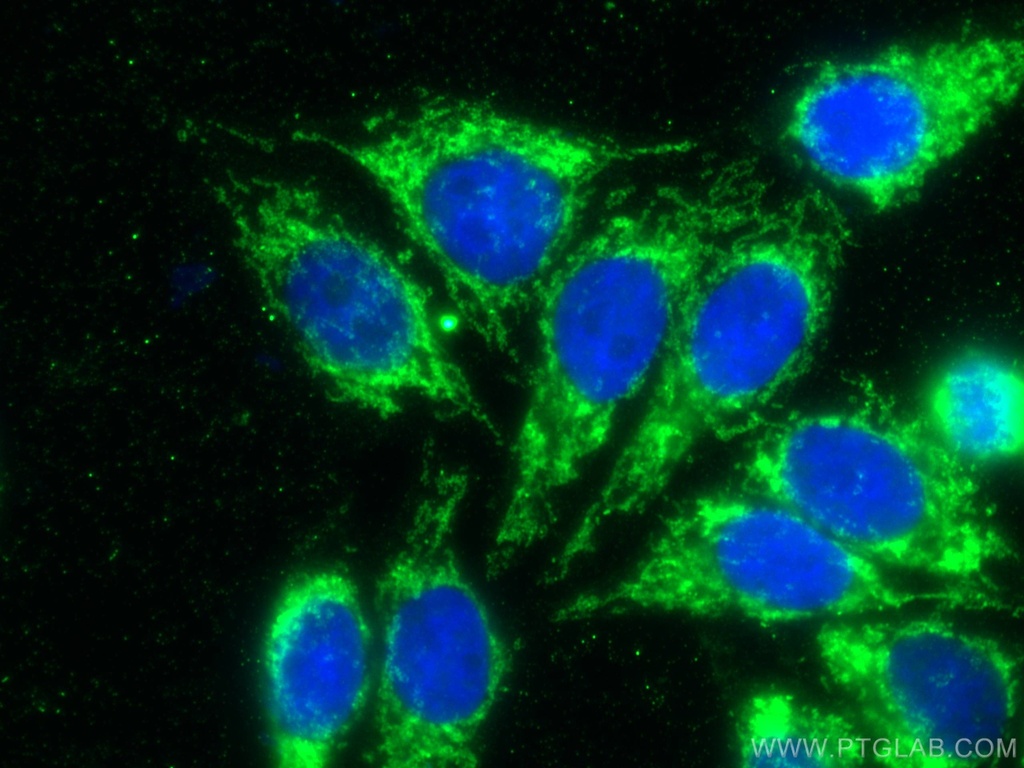 TOM20 Monoclonal antibody