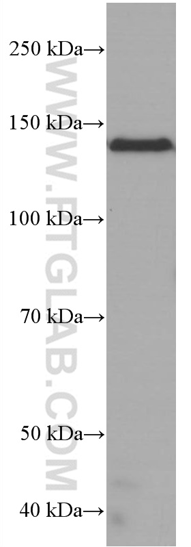RGS3 Monoclonal antibody