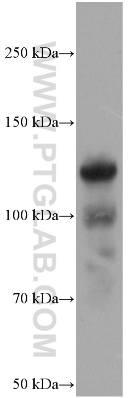 COMP Monoclonal antibody