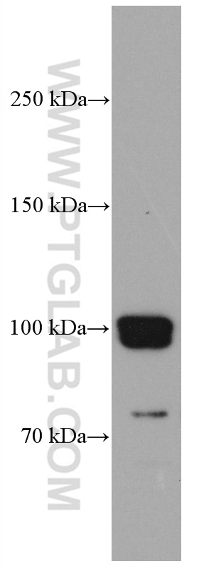 CNKSR1 Monoclonal antibody