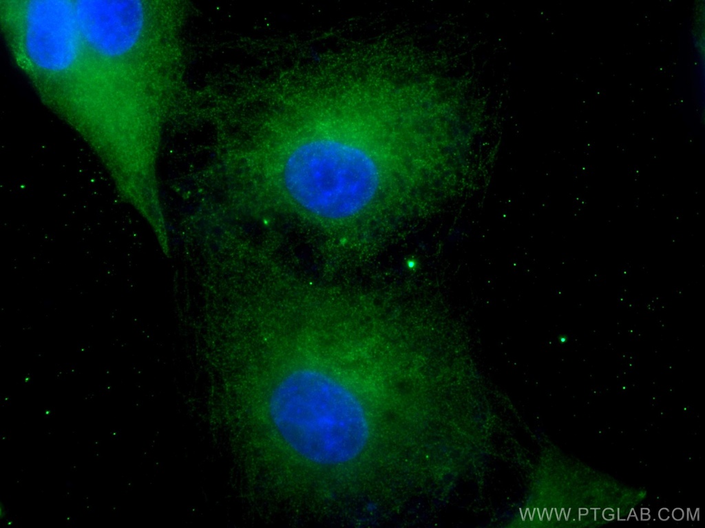 HPGD Monoclonal antibody