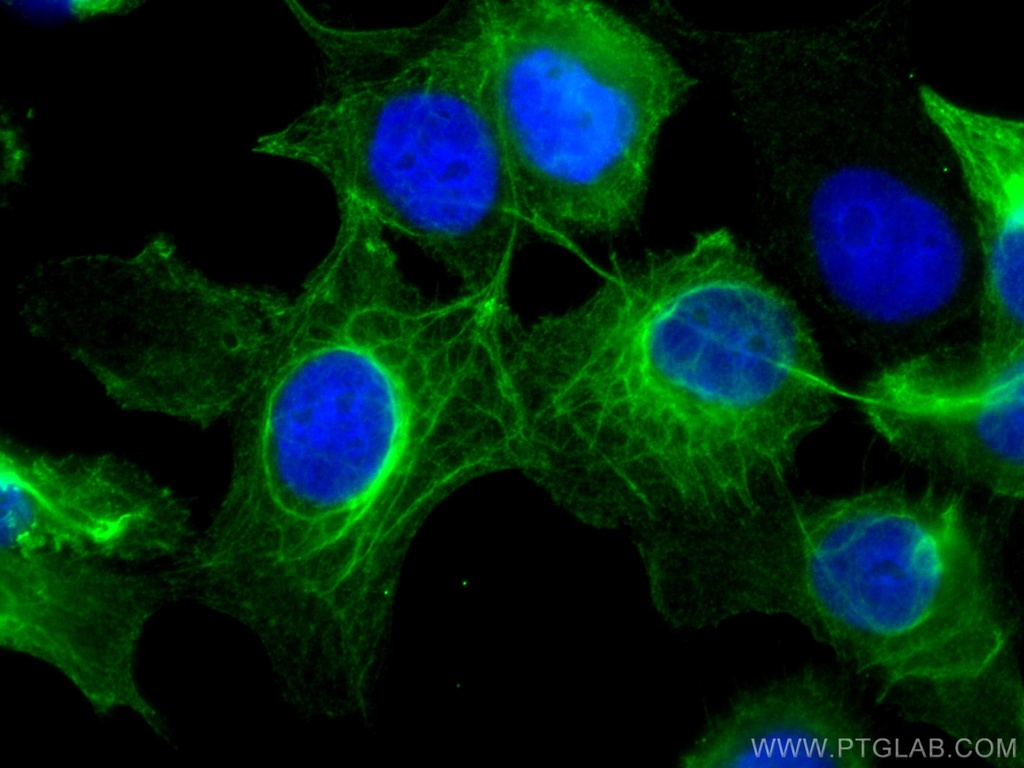 Cytokeratin 16 Monoclonal antibody