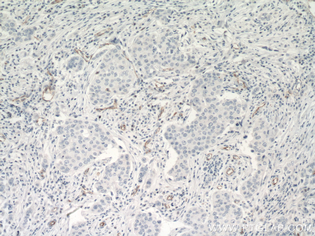 VE-cadherin Monoclonal antibody