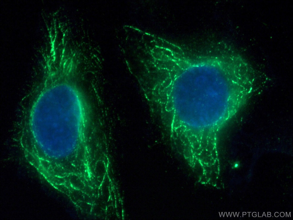 FFAR3 Monoclonal antibody