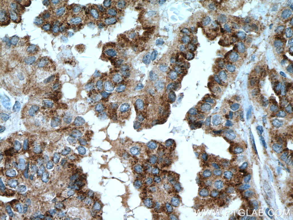 DIO2 Monoclonal antibody