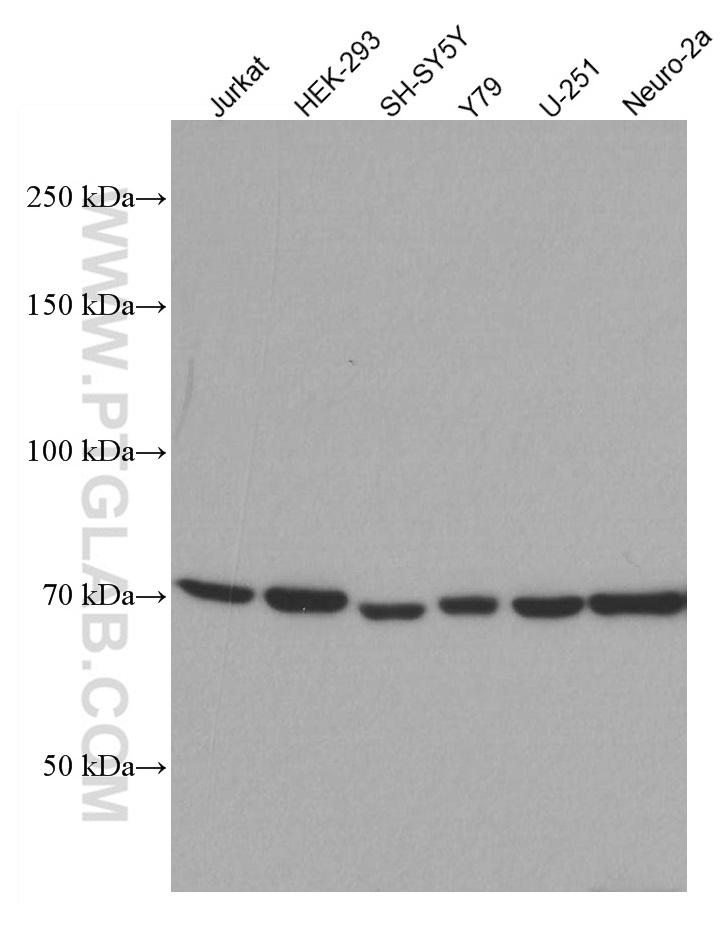 CHAT Monoclonal antibody