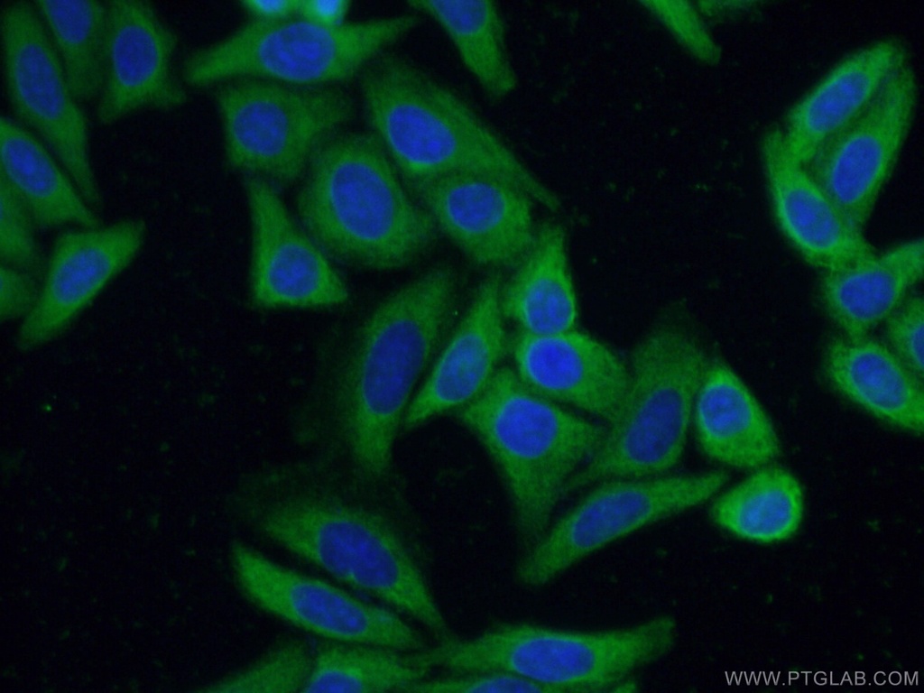 MBNL1 Monoclonal antibody