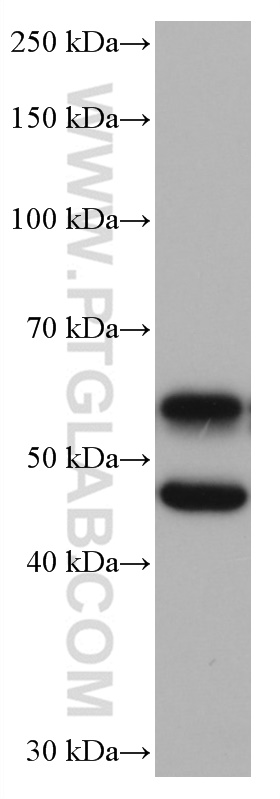 CAMK2 Monoclonal antibody