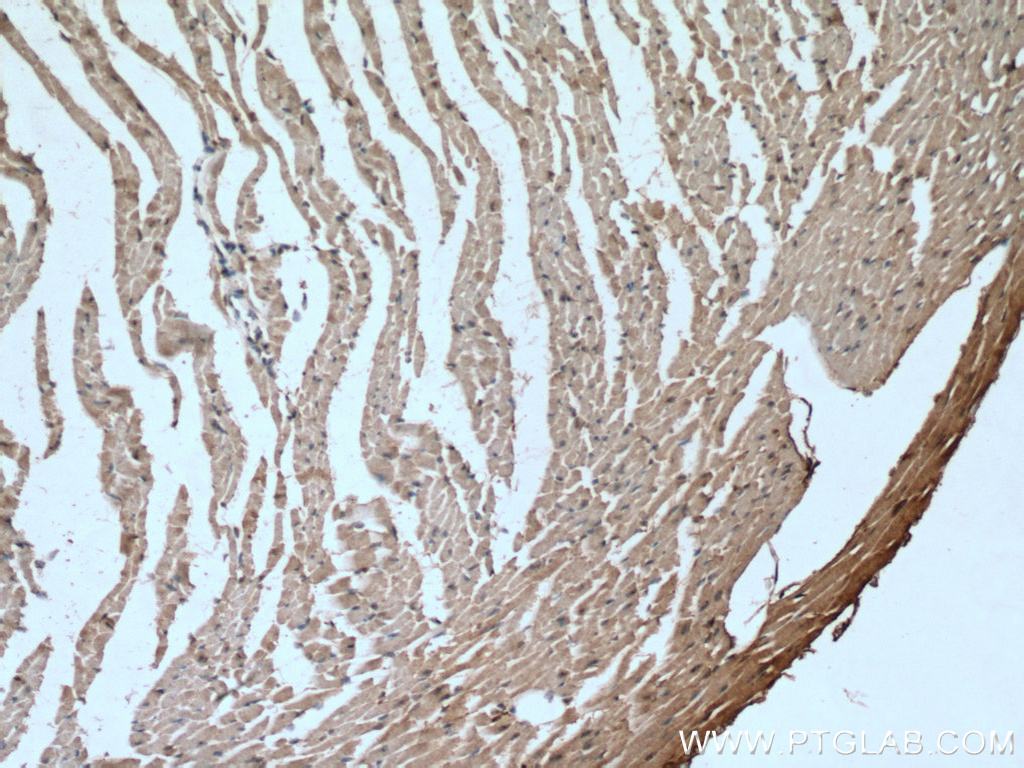 GLUT4 Monoclonal antibody