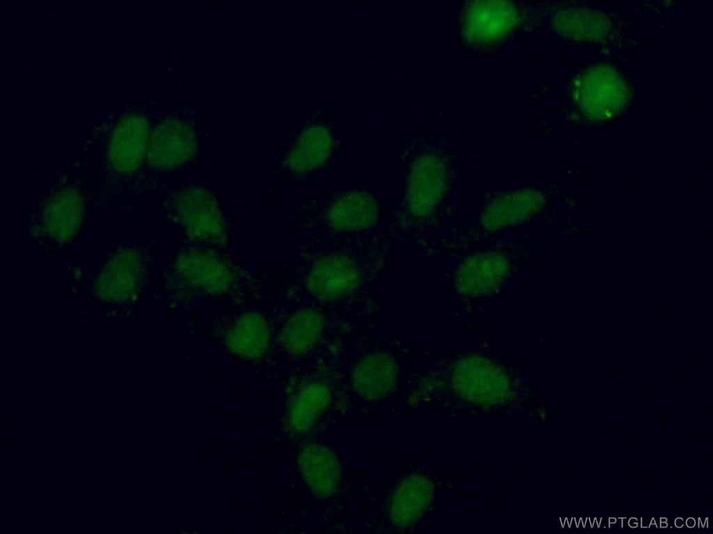 XRN2 Monoclonal antibody