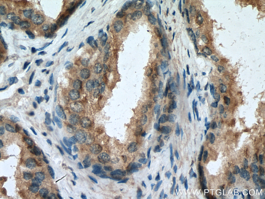 SPON2 Monoclonal antibody