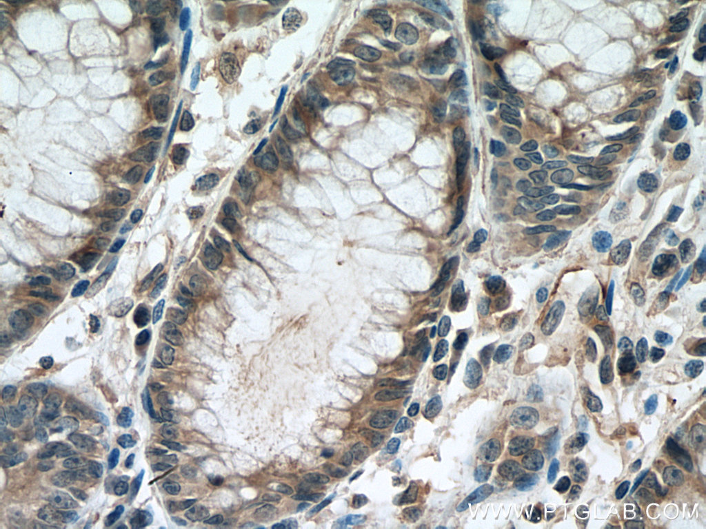 STIL Monoclonal antibody