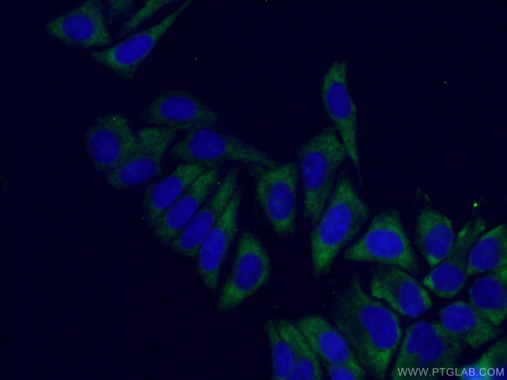 RPS6 Monoclonal antibody