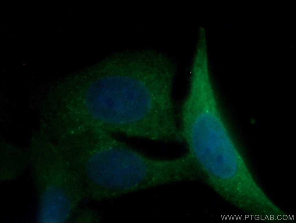 YAP1 Monoclonal antibody