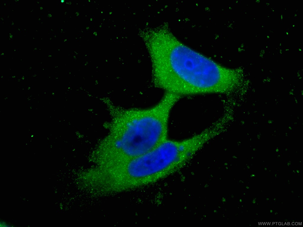 TIAR Monoclonal antibody