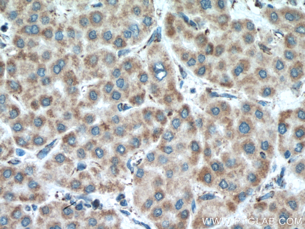 MAVS; VISA Monoclonal antibody